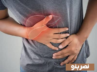 کبد چرب و علائم آن