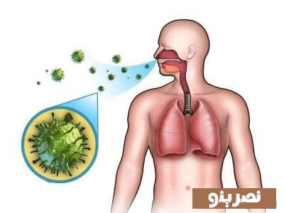 علایم عفونت ریه و روش های درمان آن 