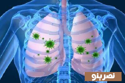 بهبود عفونت ریه