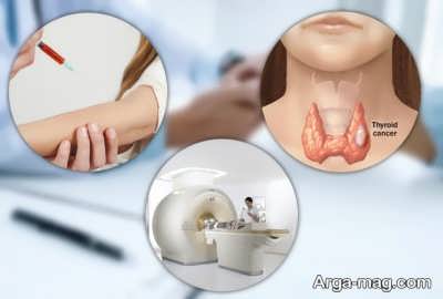 علائم تیروئید پرکار