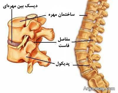 درمان های توانبخشی برای درمان قطعی دیسک کمر