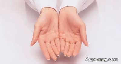 عرق کف دست از علت تا درمان 