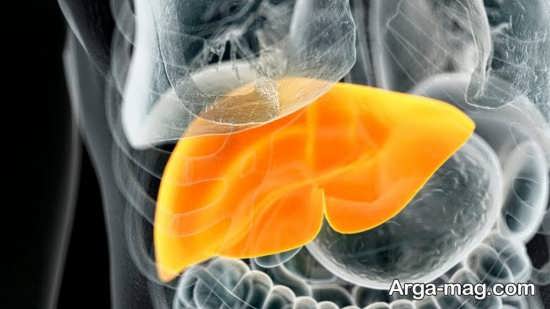 چه چیزی باعث به وجود آمدن کبد چرب گرید2 می شود؟