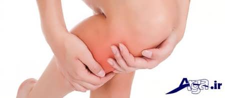 گرفتگی پا و کمبود ویتامین دی