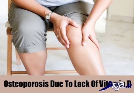 نشانه های کمبود ویتامینD