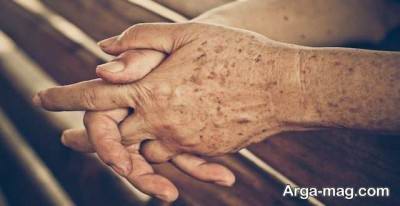 علا پیر شدن دست و چرو شدن آنها چیست