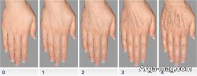 روند جوانسازی پوست درد