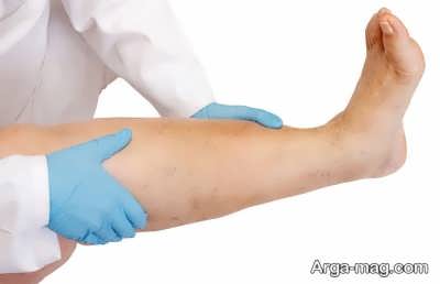 راه های درمان خانگی پا درد