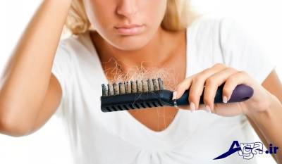 درمان ریزش مو با آب پیاز