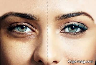 رفع سیاهی دور چشم با روغن نارگیل