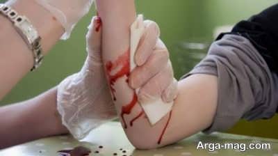 خونریزی و میوه گل نسترن