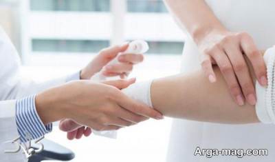 استفاده از آلفا