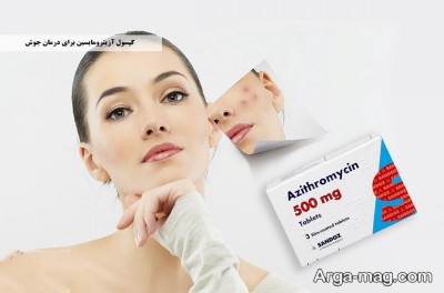 عوارض مصرف قرص آزیترومایسین