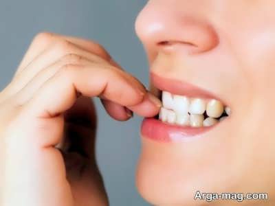 داروی ضد استرس کلردیازپوکساید