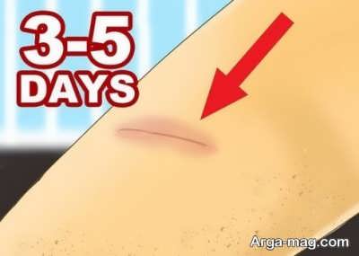 عملکرد پماد باکتروبان