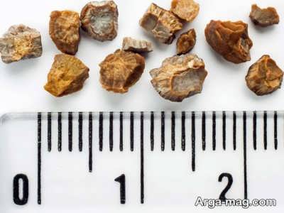 عکس سنگ های عجیب کلیه