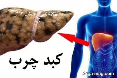 روش های پاکسازی کبد در پنج روز