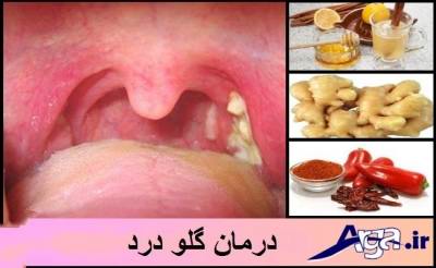 درمان گلو درد