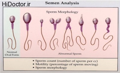 semen-analysis